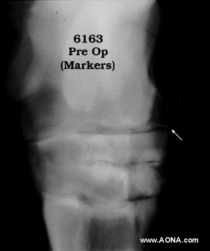 Intraoperative marking of the proximal intertarsal joint