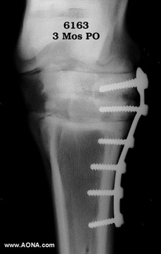 3 month follow-up radiograph