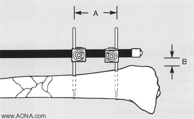 Frame Biomechanics - Factors that Increase Frame Stability