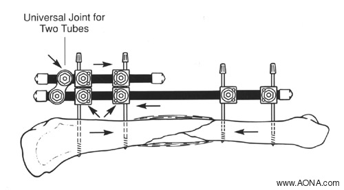 Dynamize the Frame, Double Stack the Frame, Crosswise Release