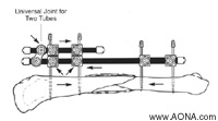 Double Stack the Frame, Crosswise Release