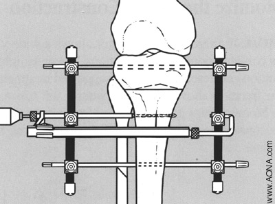 Predrill for Pin