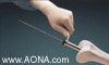 Titanium Distal Femoral Nail System