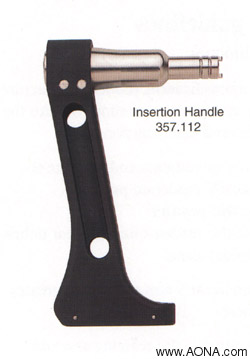 Titanium Distal Femoral Nail System