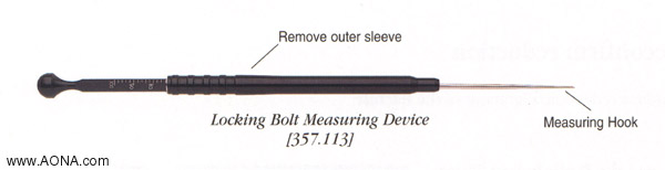 Titanium Distal Femoral Nail System