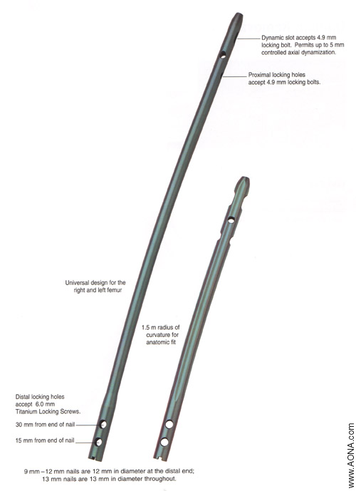 Titanium Distal Femoral Nail System