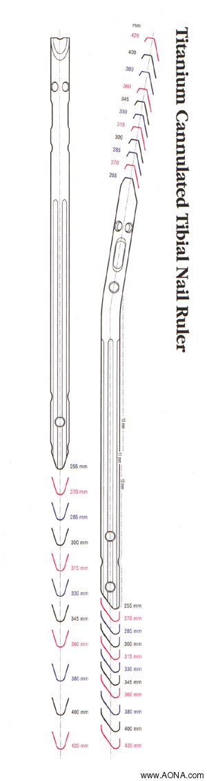 Preoperative Implant Selection