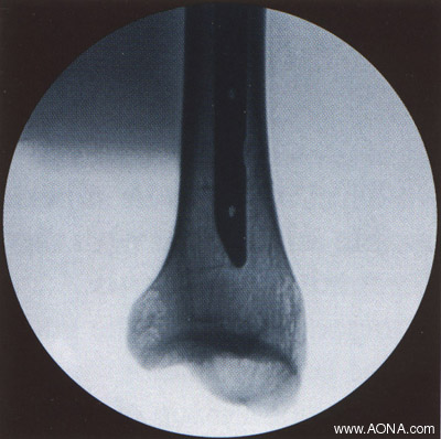 align image: oblique - incorrect