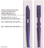 implant specifications - titanium tibial nails - solid and cannulated