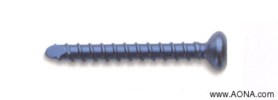 3.9 mm Titanium Locking Bolt - blue