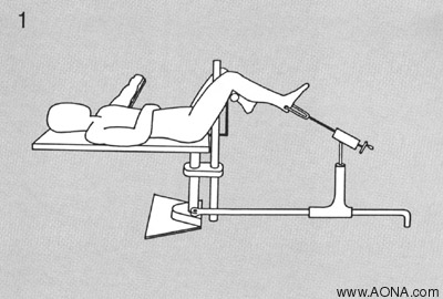 fracture table