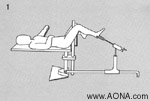 Positioning on a Fracture Table