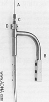 Slide the tibial nail over the 3.0 mm Guide Rod