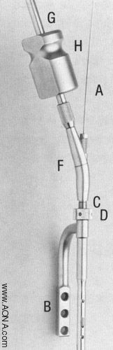 Alternate Insertion Assembly