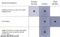 nail insertion entry point