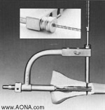 measure for the proper length 4.9 mm Locking Bolt using depth gauge