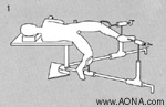 Lateral Positioning on a Fracture Table