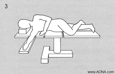 Lateral Positioning on a Fracture Table