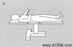 Supine Positioning on a Standard Table