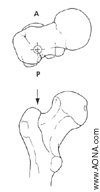 nail insertion entry point