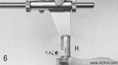 Mount the appropriate Holding Sleeve (E or H) onto the end piece