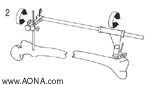 Rotation Loosen both Spindle Nuts