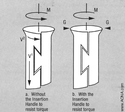 loosen the Locking Nut